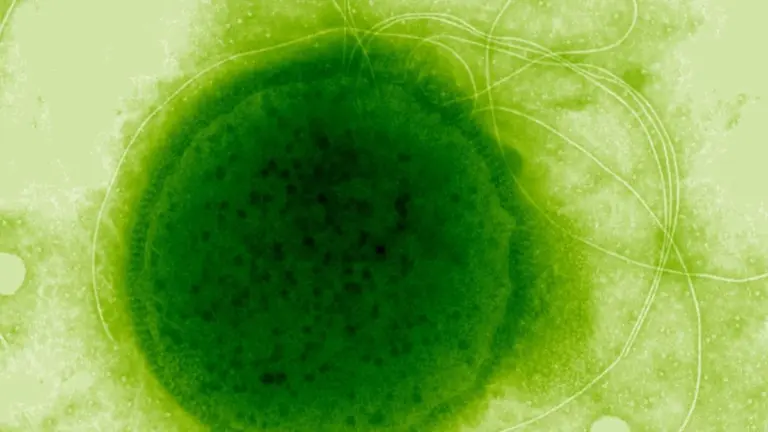 Proč hlubinný mikrob přežije 30 000 grayů, i když v moři žádná radiace není