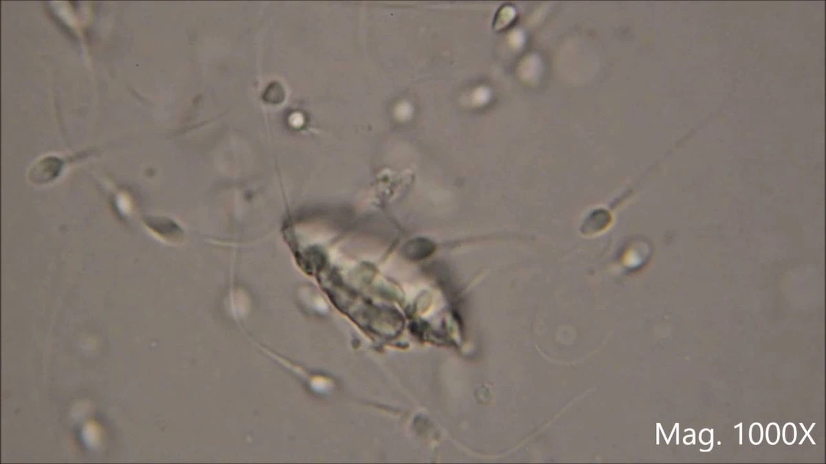 Proč se spermie v lednu 2026 vymykají fyzice: Newtonův zákon u nich neplatí - image 1