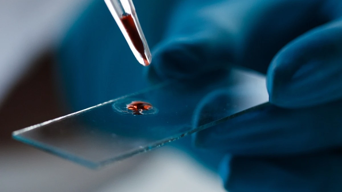 Proč vědci měří hladinu p-tau217 v krvi pro předpověď Alzheimera