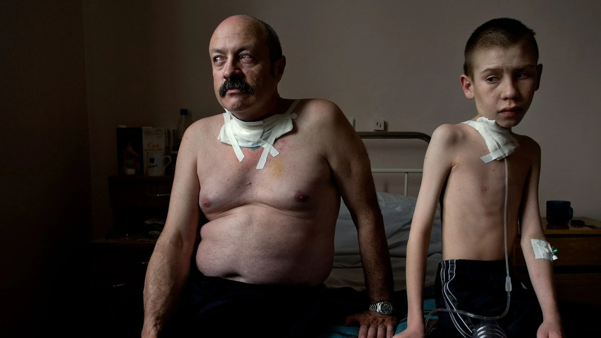 Průlom v Černobylu: Jak radiace v roce 1986 mění DNA dětí i dnes - image 1