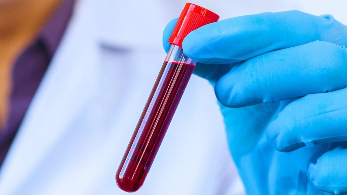 Proč mají stoletý lidé krev jako třicátníci: vědci našli 37 proteinů mládí