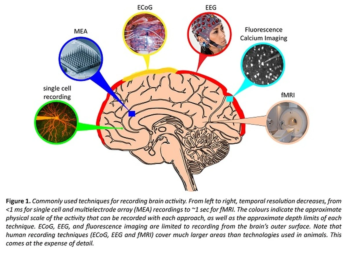 Proč mozek na psychedelikách vidí vzpomínky místo reality: Vědci odhalili mechanismus 
