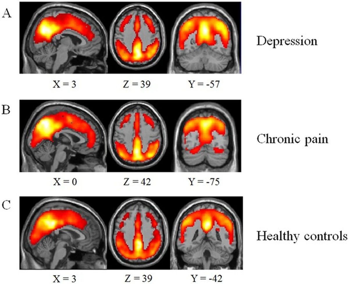 Proč někteří lidé s chronickou bolestí propadají depresi a jiní ne: Vědci našli viníka v hippocampu - image 1