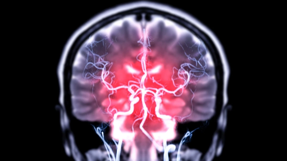 Proč se v mozku objevují střevní bakterie a jak to zastavit