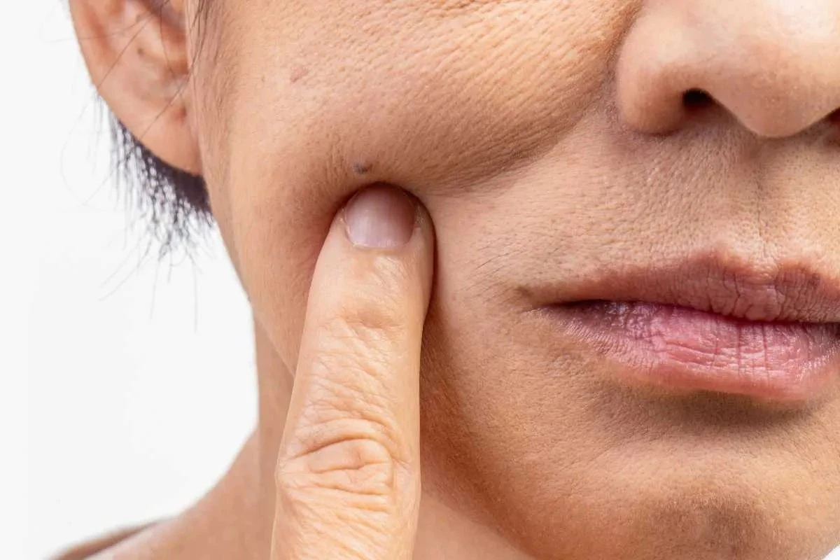 Proč stres vyvolává svědění: Vědci našli v kůži nervové spojení, které zhoršuje ekzém - image 1