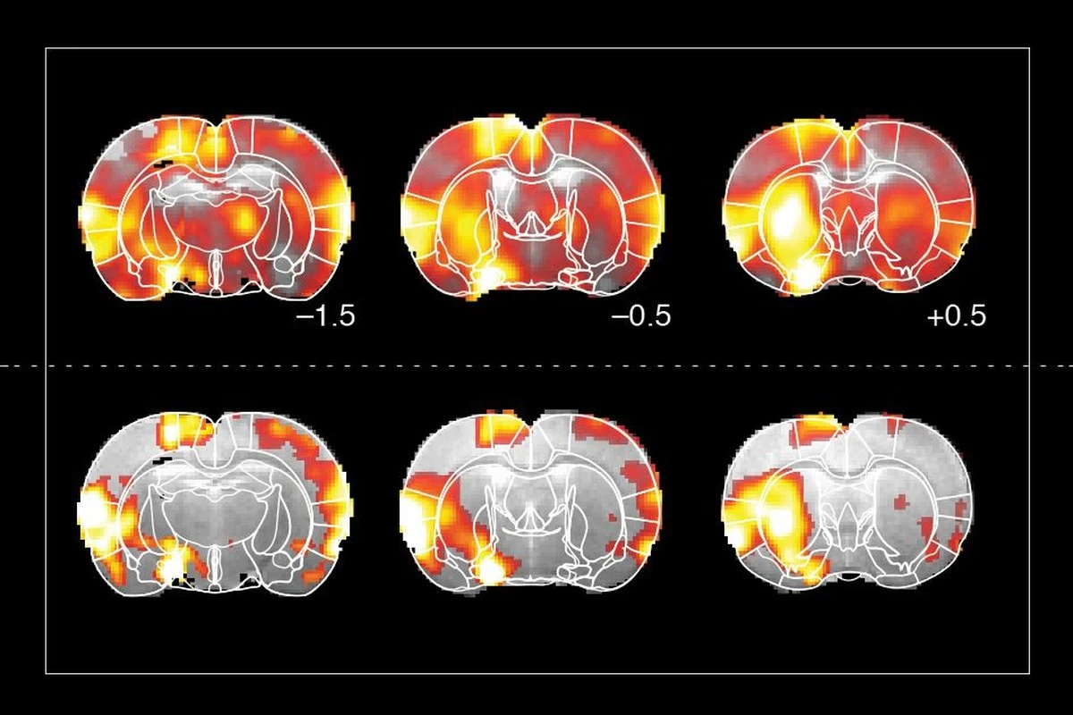 Proč zkušení neurologové začali sledovat hladinu dopaminu u mladých lidí s autismem - image 1