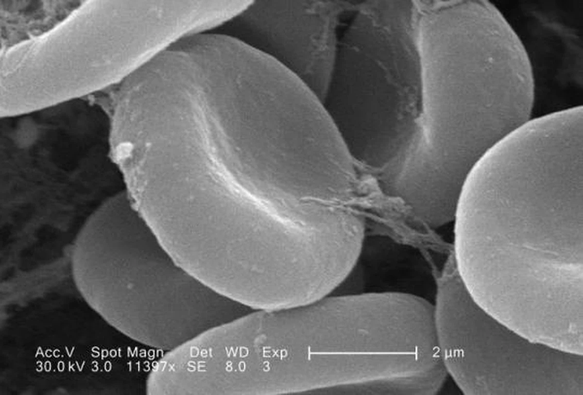 Vědci přišli na to, proč adenovirové vakcíny způsobovaly vzácné sraženiny - image 1