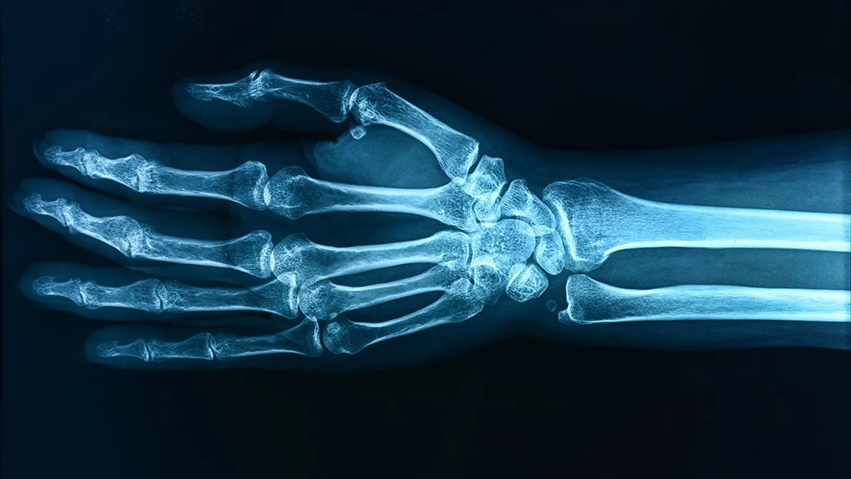 Proč mají české děti křehčí kosti: Vědci ukázali na konkrétní věc v našich kuchyních