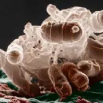 Proč některá antibiotika zhoršují zánět v těle i po zabití bakterií