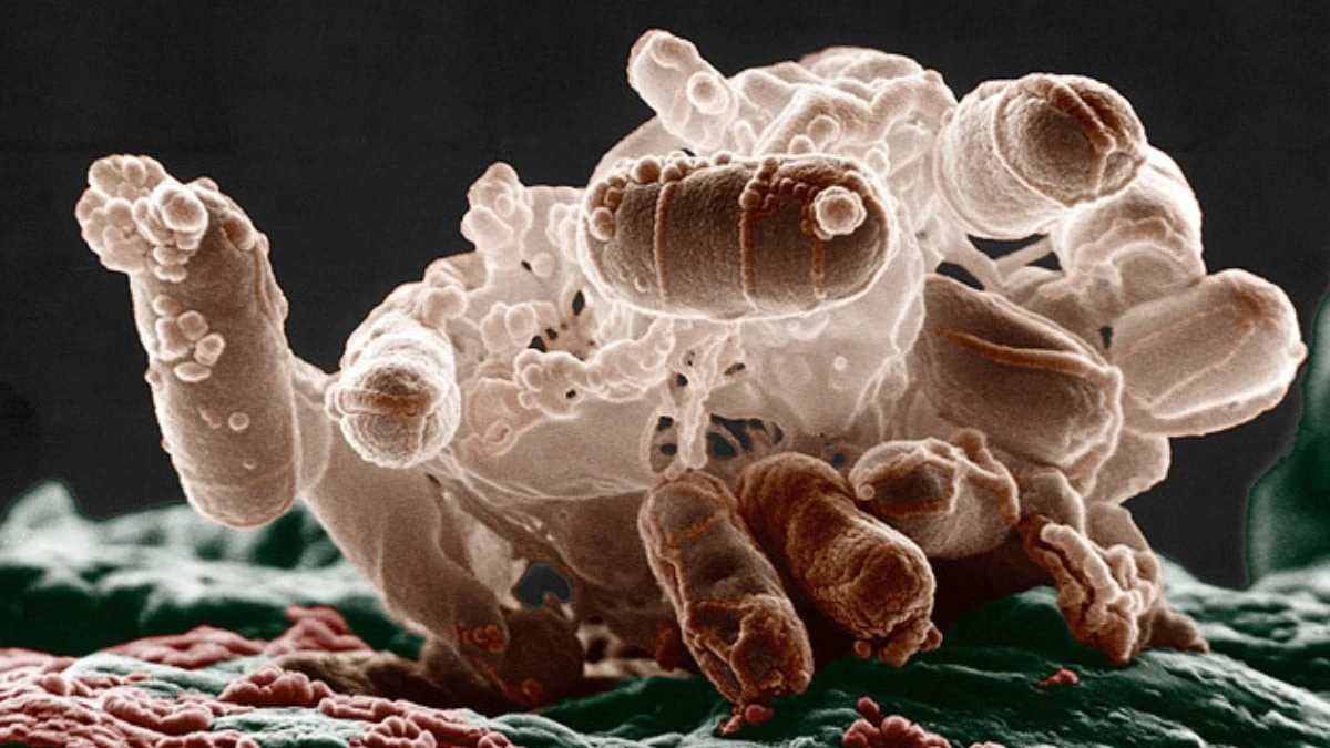 Proč některá antibiotika zhoršují zánět v těle i po zabití bakterií