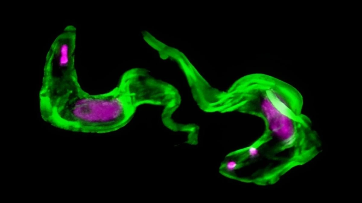 Proč parazit spavé nemoci uniká imunitě: Vědci objevili jeho molekulární skartovačku
