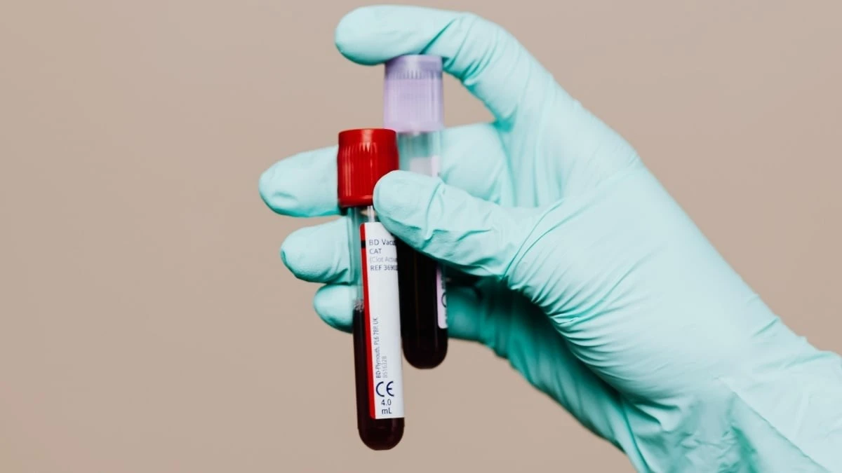 Proč se v krvi objevuje tichý signál Alzheimera roky před první zapomenutou věcí