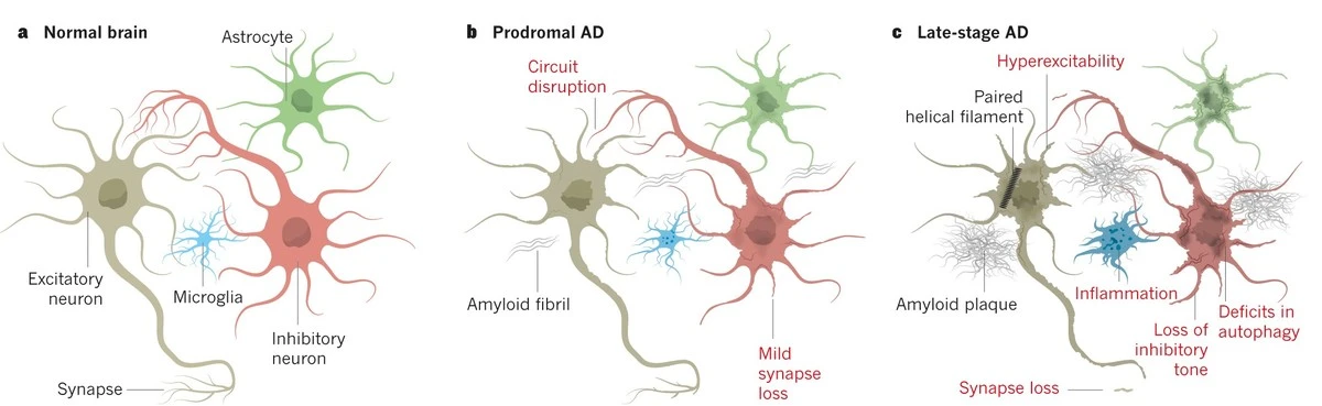 Proč se v mozkvých buňkách po lécích na hubnutí snižuje množství škodlivých proteinů - image 1