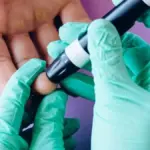 Proč se v roce 2025 oficiálně začalo mluvit o cukrovce 5. typu