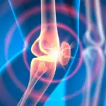 Proč vědci nyní píchají tuto látku do kloubů k obnově chrupavky