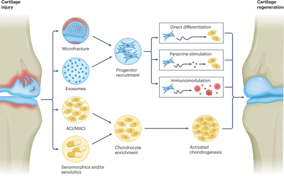 Proč zkušení lékaři začínají mluvit o konci éry umělých kolen díky blokování jednoho proteinu - image 1
