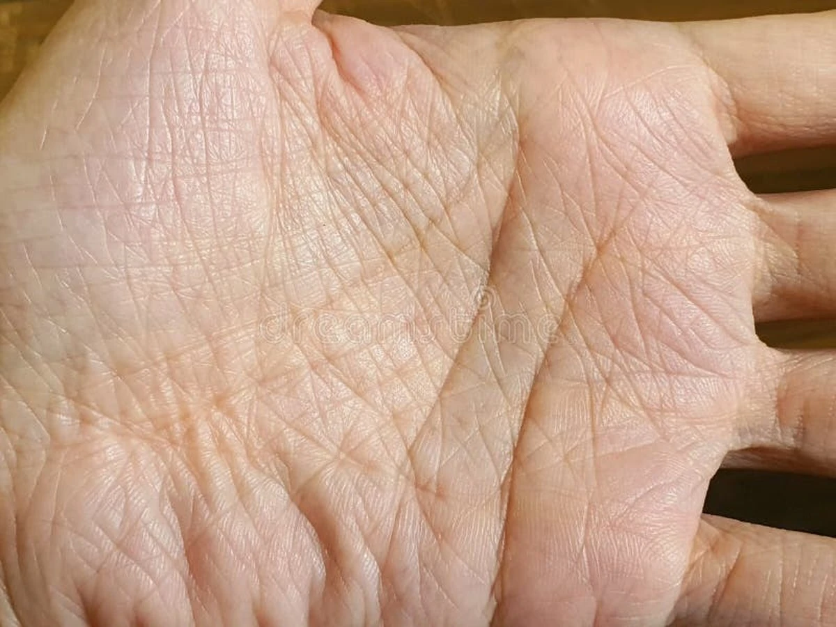 Všimněte si luku pod ukazováčkem: Co o vás prozradí vzácný Šalamounův prsten - image 1