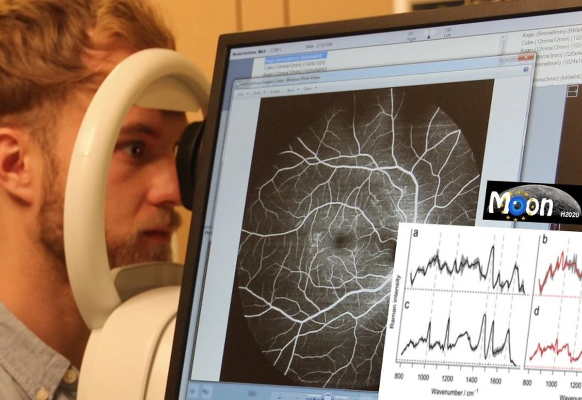 Proč lékaři přejmenovali PCOS a jak vaše oči prozradí riziko osteoporózy - image 1