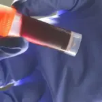 Proč lidé s krevní skupinou A mají vyšší riziko sraženin před šedesátkou