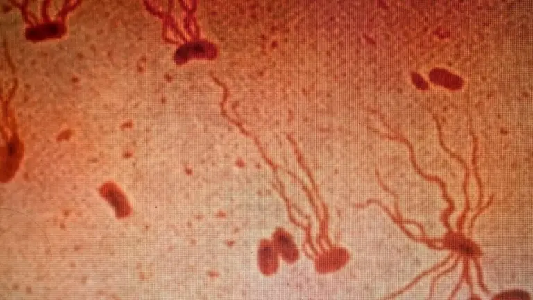 Proč poslední dostupná antibiotika přestávají fungovat na břišní tyfus