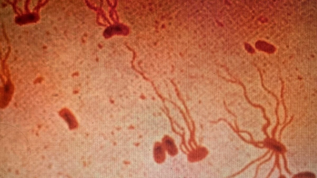 Proč poslední dostupná antibiotika přestávají fungovat na břišní tyfus