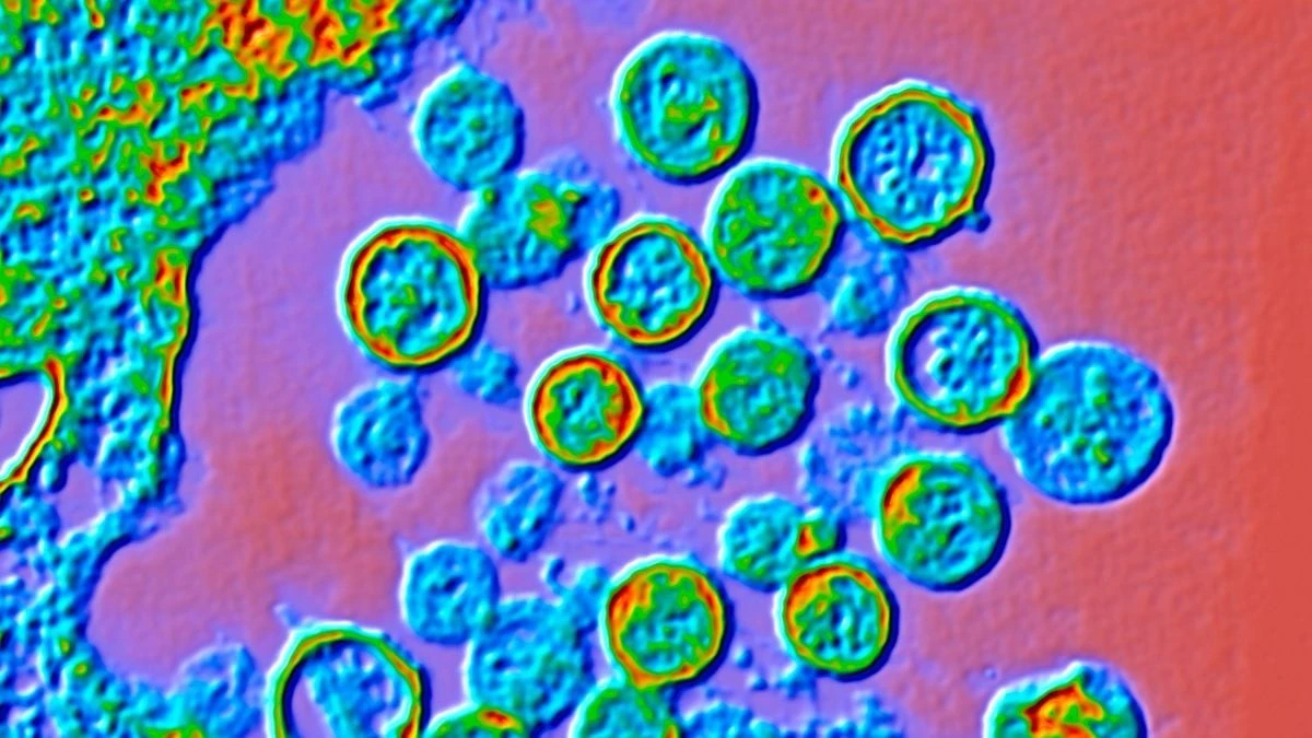 Proč se na luxusní lodi v Atlantiku rozšířil vzácný virus: Tři lidé nepřežili