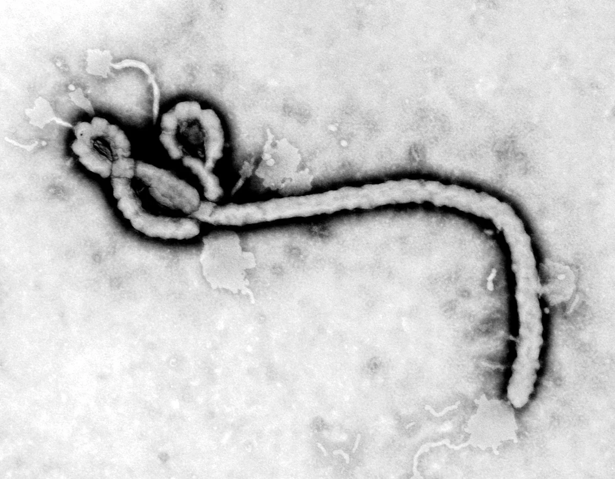 Proč se v Africe šíří kmen Eboly, na který nezabírají běžné vakcíny - image 1