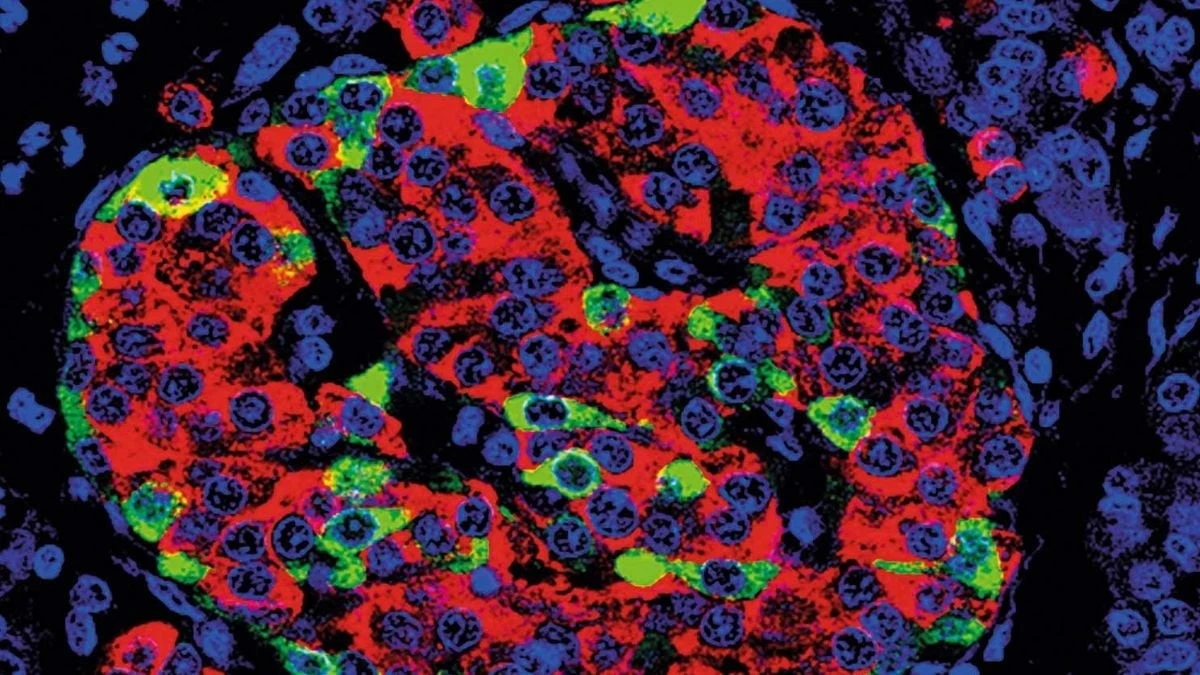 Proč se v laboratořích pěstují inzulínové buňky z vlastního tuku