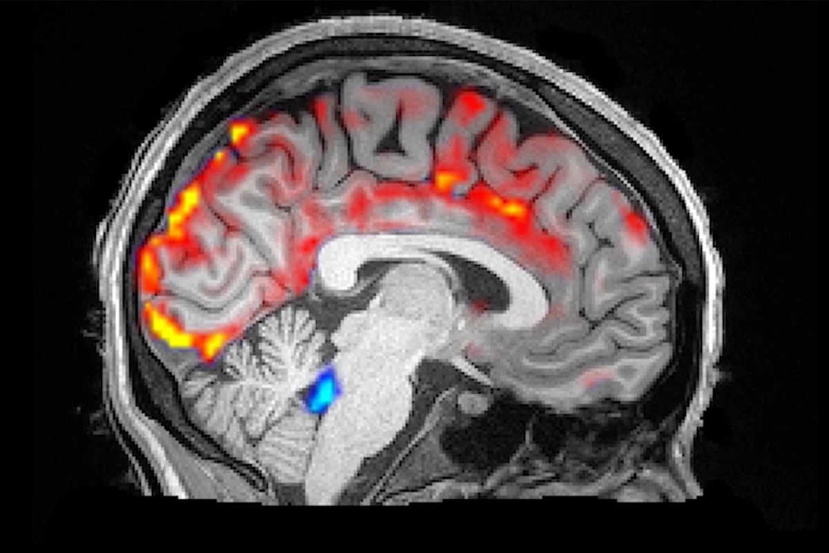 Proč se v mozku během spánku spouští čisticí proces, který nás chrání před demencí - image 1