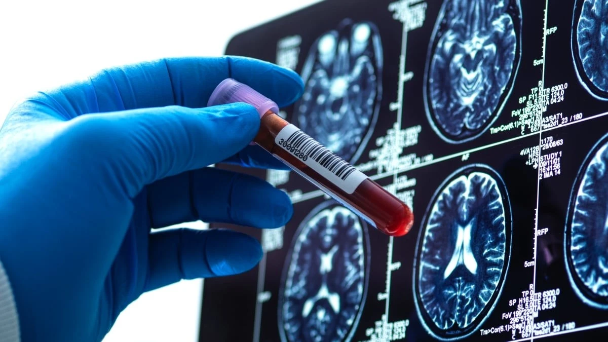 Vědci zjistili, že deprese mění krev: Vaše buňky stárnou rychleji, než by měly