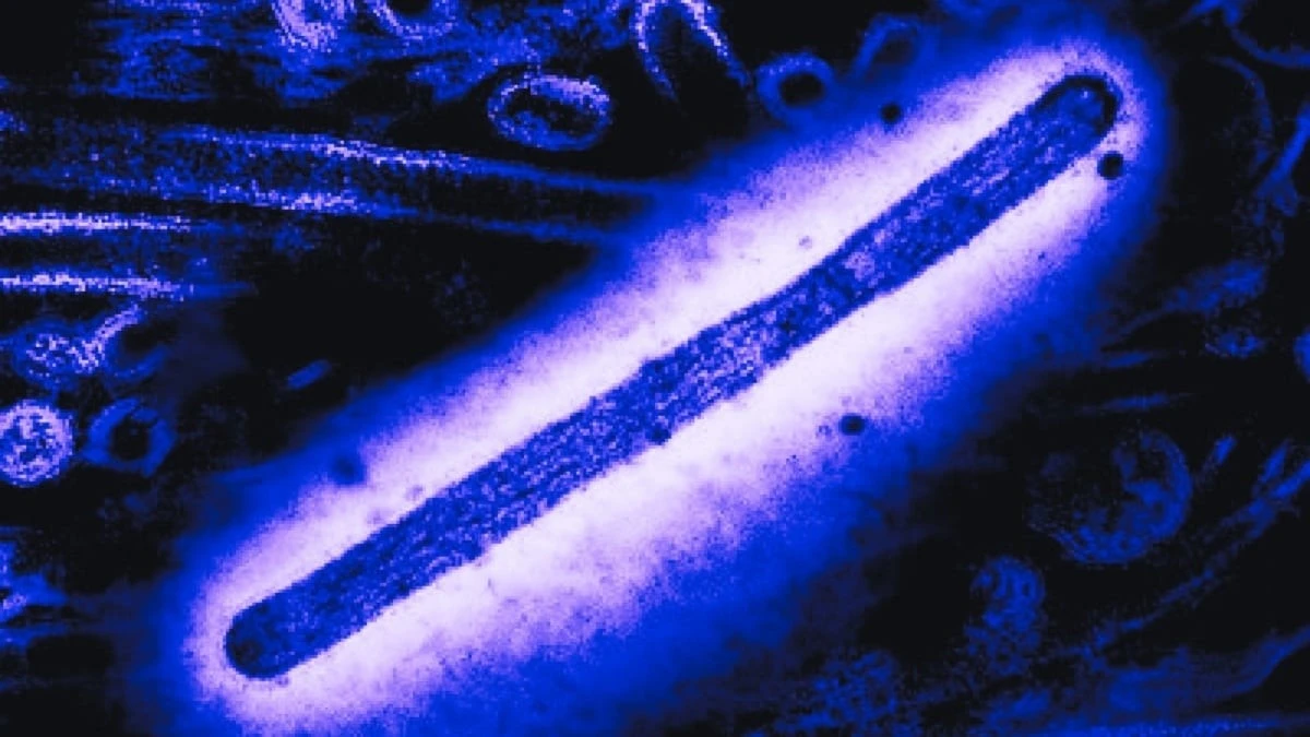 Proč se zkušení biologové obávají dvou nemocných ptáků na australské pláži