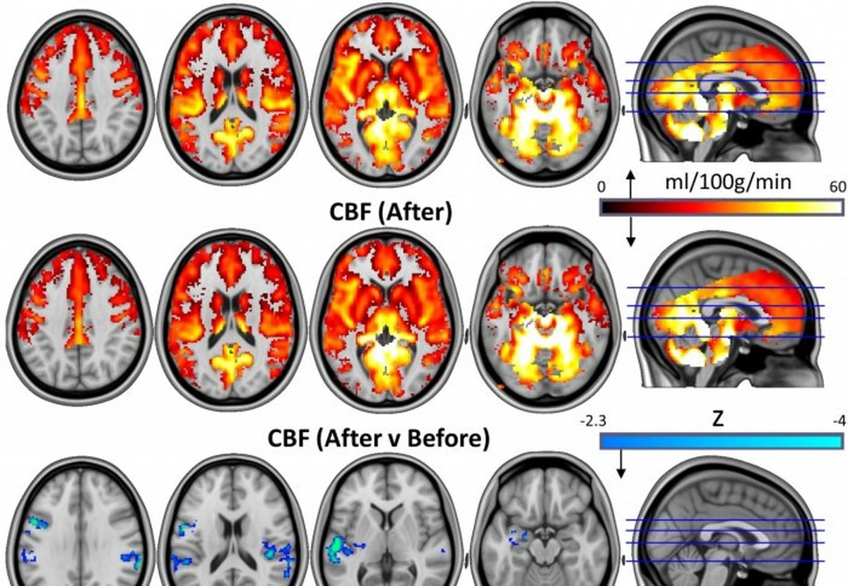Proč zkušení neurologové začínají sledovat vliv psilocybinu na stárnoucí mozek - image 1
