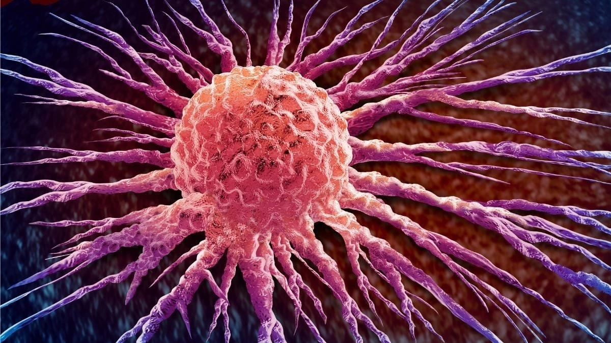 Proč zkušení onkologové nasazují novou pilulku místo běžné chemoterapie