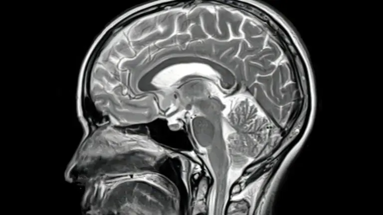 Proč léky na Alzheimera selhávají: V hloubi mozku se zastaví o nečekanou bariéru