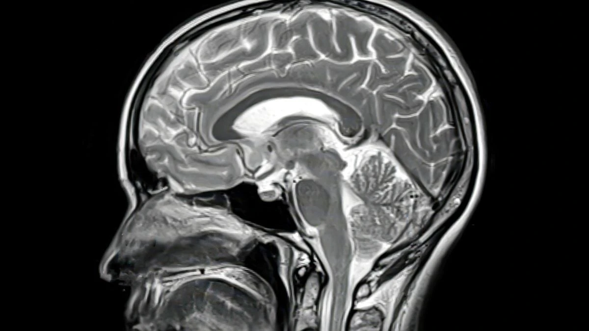 Proč léky na Alzheimera selhávají: V hloubi mozku se zastaví o nečekanou bariéru