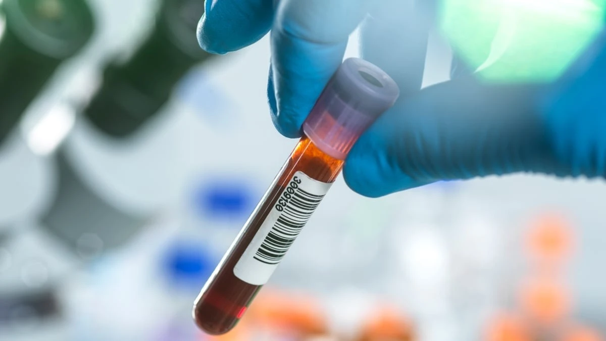 Proč se anorexie vrací: Vědci našli v krvi hormonální brzdu, která vypíná hlad