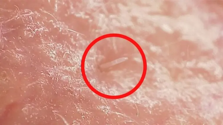 Proč se na vaší tváři právě teď páří tisíce tvorů, kterých se už nikdy nezbavíte