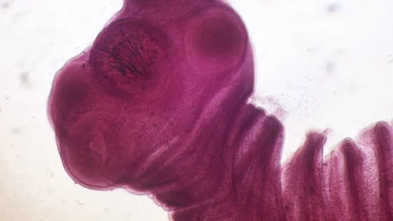Proč se z balených salátů stal risk: Důvod, proč je raději znovu umýt