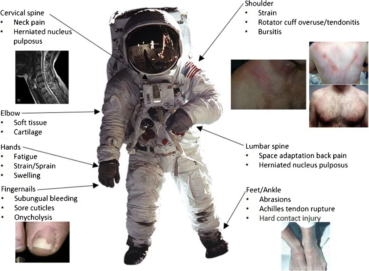 Proč zkušení vědci doporučují listovou zeleninu pro ochranu kloubů v extrémních podmínkách - image 1